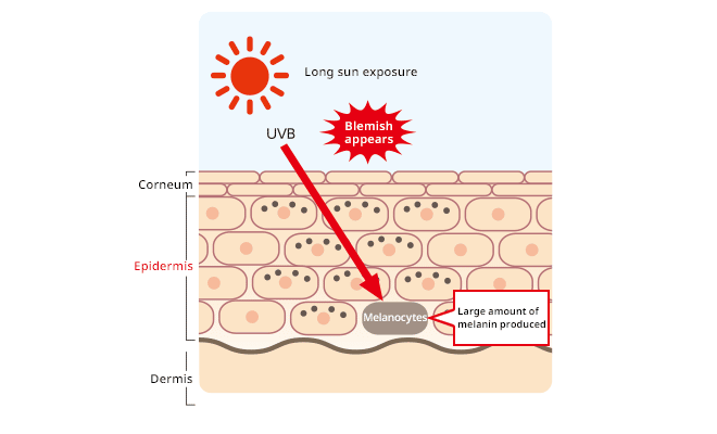 Protect from photoaging | SEKISUI S-LEC